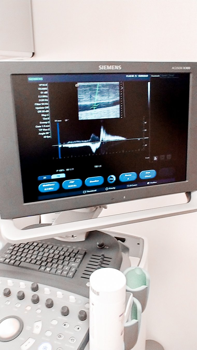 Co łączy zastawki żylne i regał na książki ? Refluks żylny- czym jest ?