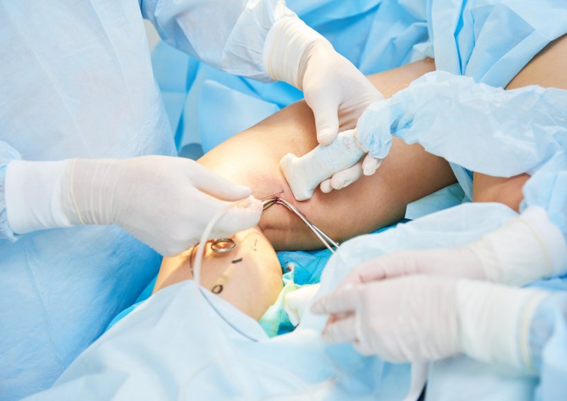 Pomoc po nieudanych zabiegach