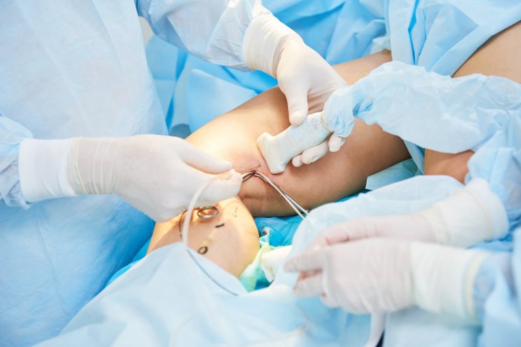 Pomoc po nieudanych zabiegach