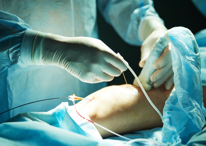 Jakich preparatów używamy do skleroterapii?